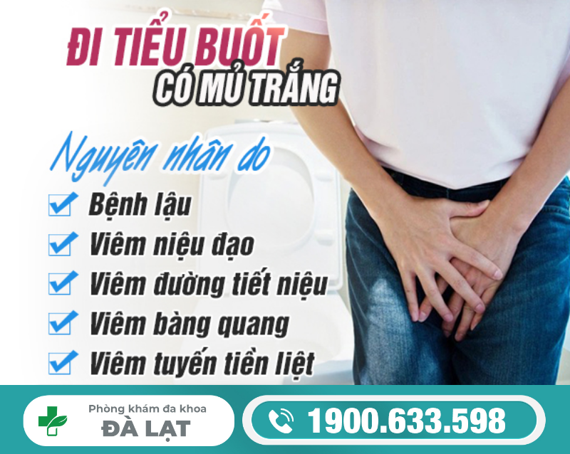 Hình ảnh minh họa